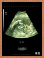 2000 Alien Resurrection PS1 Original Advertisement / Retro Wall Art v2